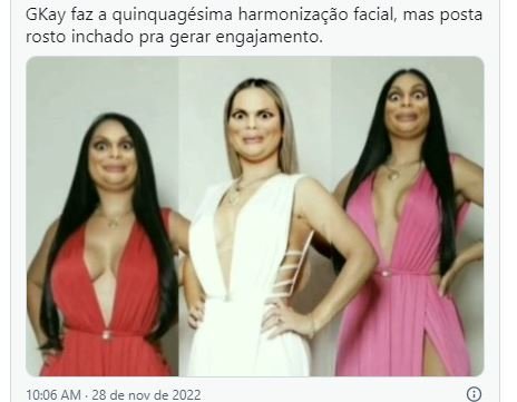 Gkay é comparada com personagem do Shrek após harmonização facial; confira